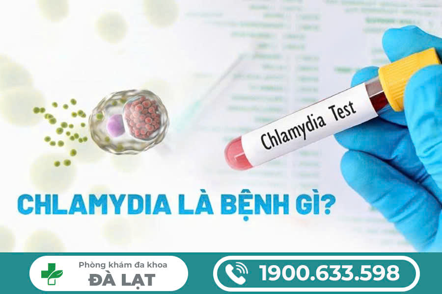 Hình ảnh minh họa